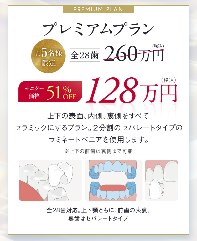 プレミアムプラン 月5名様限定 全28歯 モニター価格 51%OFF 128万円（税込）